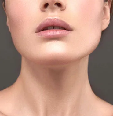 Extended Deep Plane Facelift